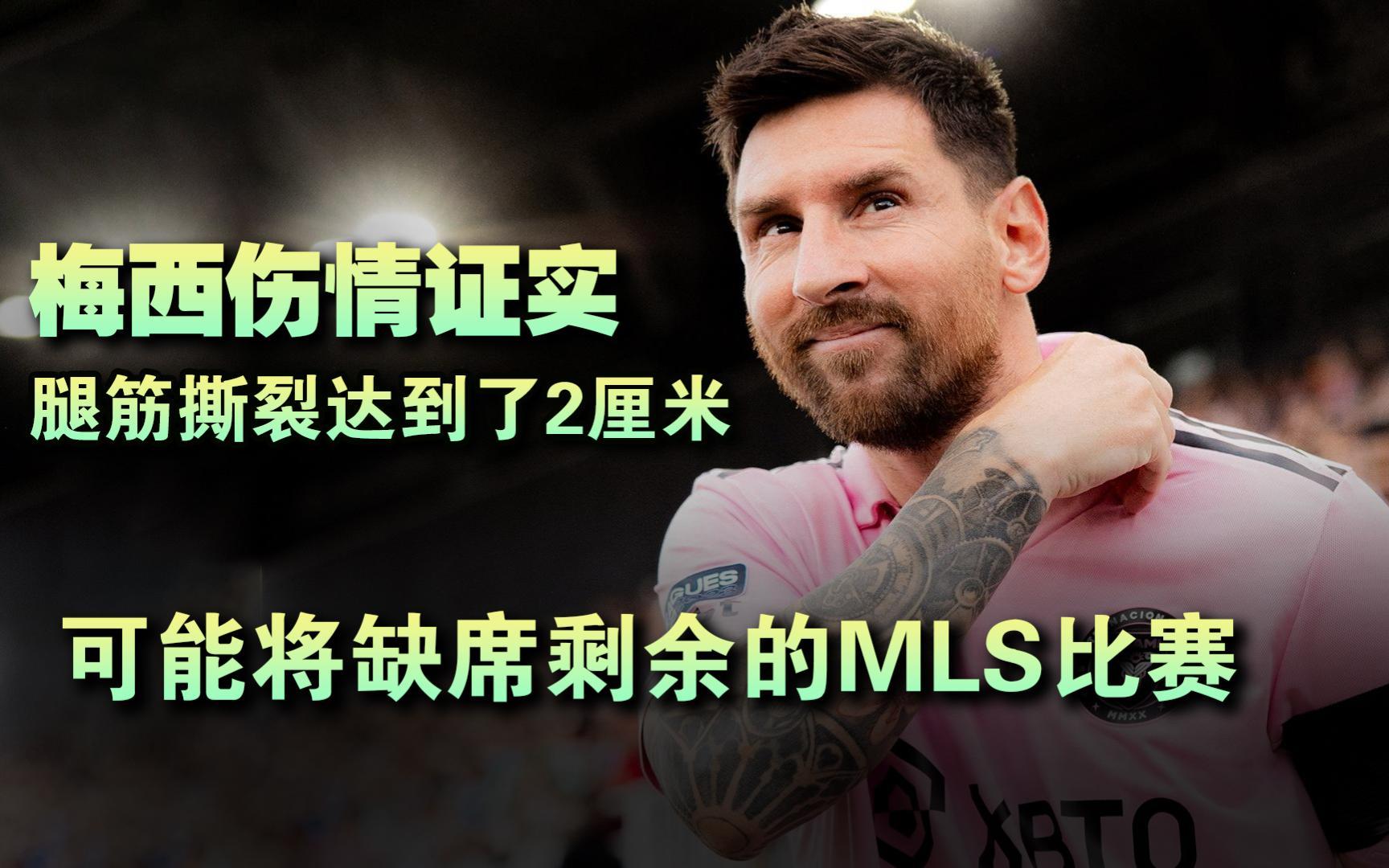 包含梅西伤情不明！巴萨星将或缺席重要一役的词条